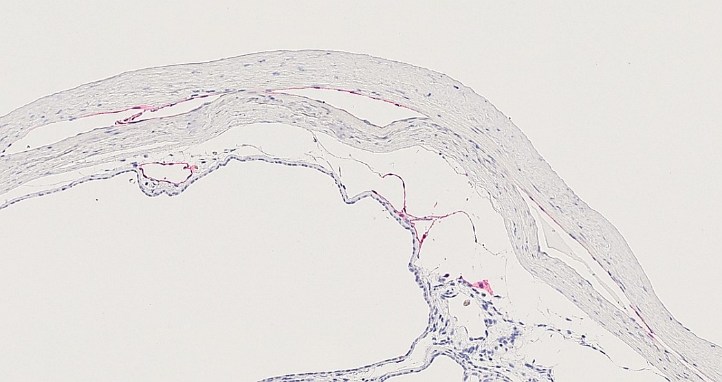 Case #31, Fig. 19